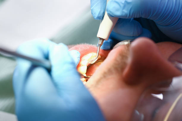 Best Emergency Treatment for Dental Infections or Abscesses in Weston, WI