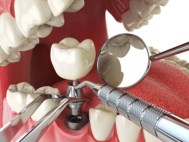 Best Emergency Dental Care for Broken or Chipped Teeth in Weston, WI